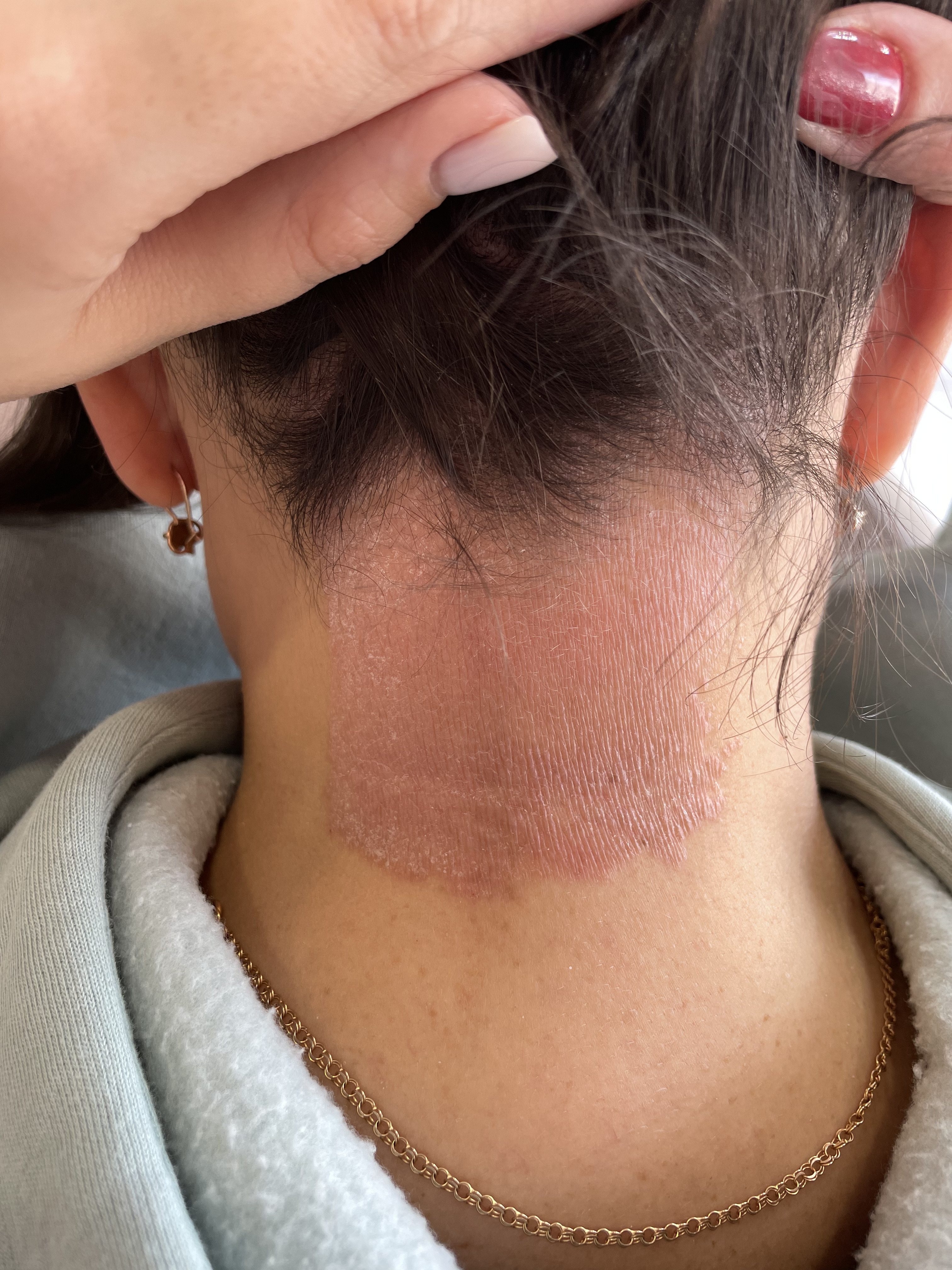 До процедури